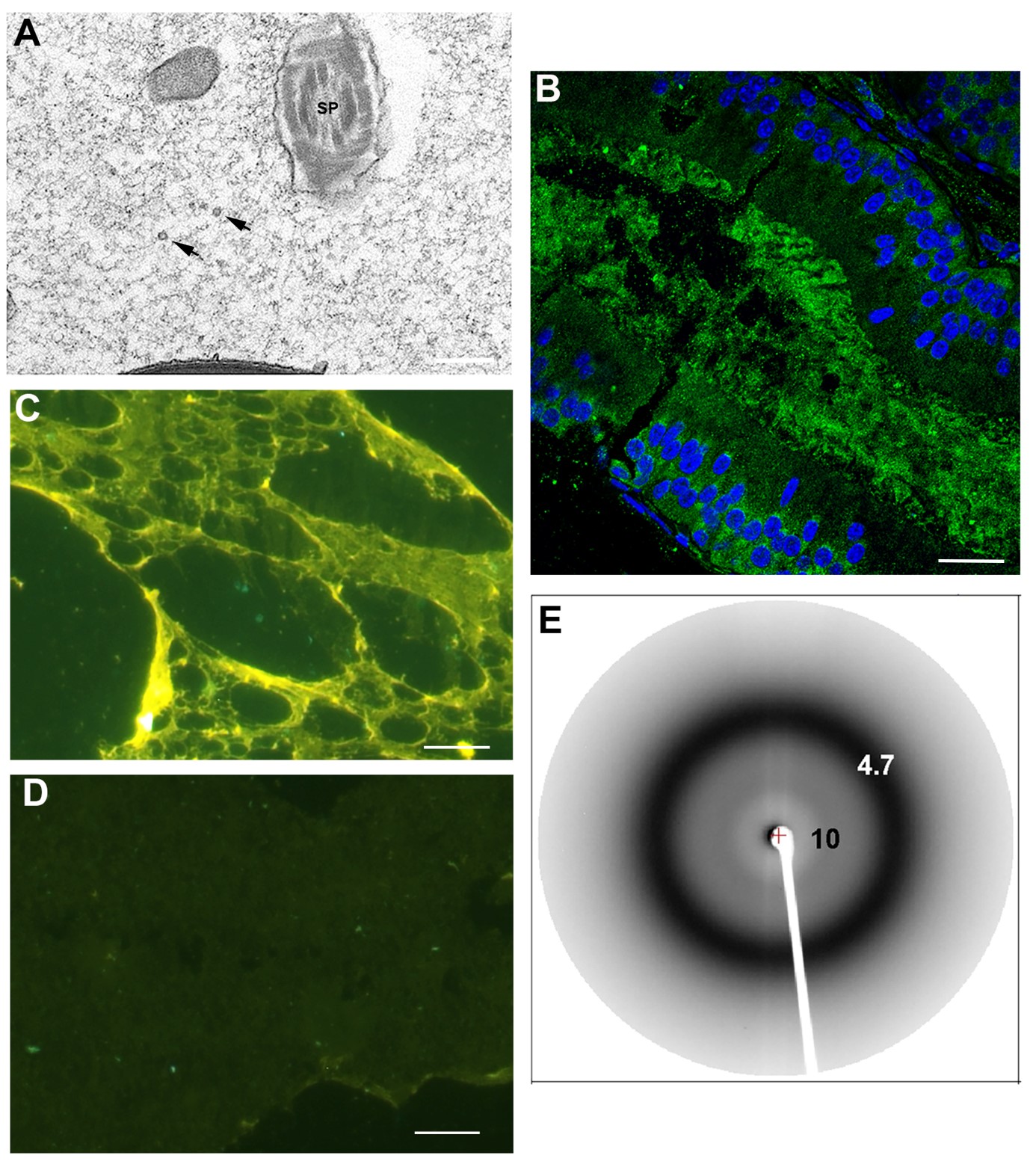 amyloid-matrix-in-the-epididymal-lumen