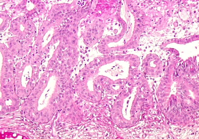 Cytology Slide