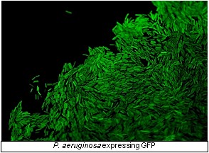 P. aeruginosa expressing GFP